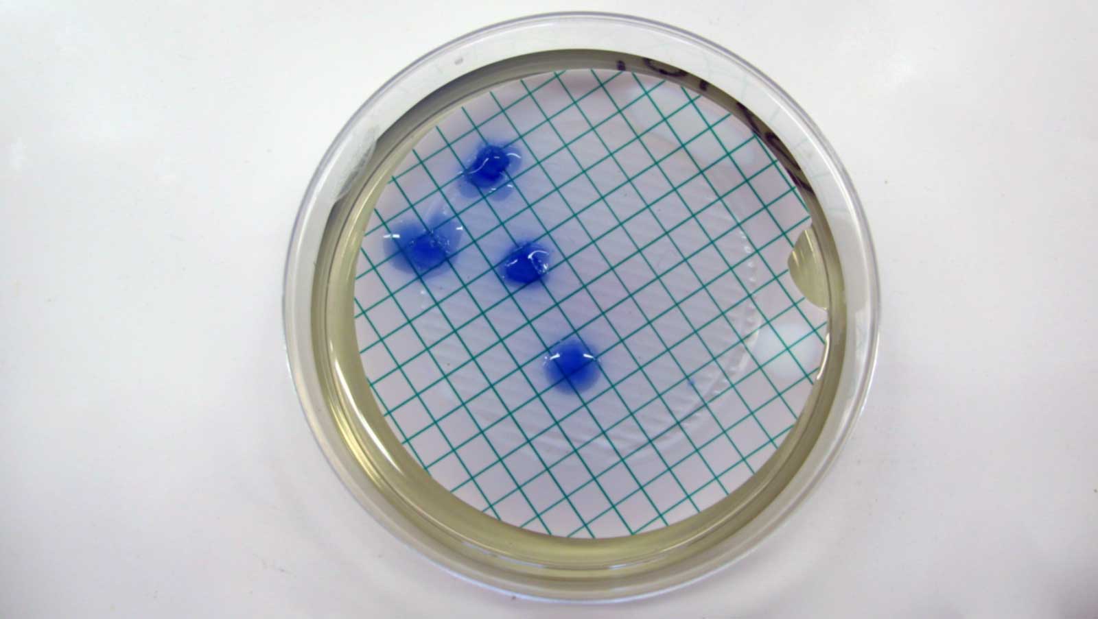 MRSA virus sample on filter